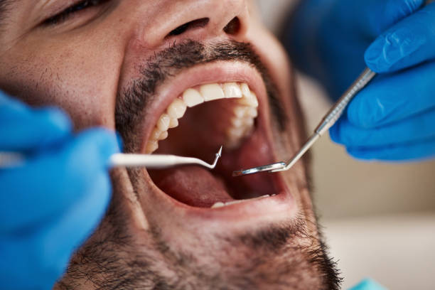 Best Oral Cancer Screening  in Hooks, TX